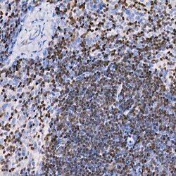 Aiolos/IKZF3 Rabbit anti-Human, Mouse, Rat, Clone: 4V2Z2, Novus Biologicals:Antibodies:Primary