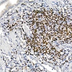Aiolos/IKZF3 Rabbit anti-Human, Mouse, Rat, Clone: 4V2Z2, Novus Biologicals:Antibodies:Primary
