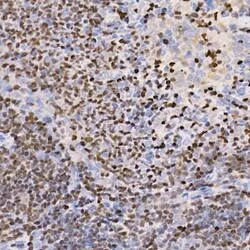 Aiolos/IKZF3 Rabbit anti-Human, Mouse, Rat, Clone: 4V2Z2, Novus Biologicals:Antibodies:Primary