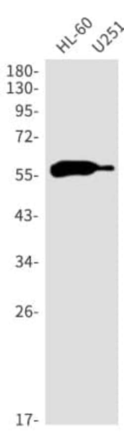 Aiolos/IKZF3 Antibody (S01-0C5), Novus Biologicals 50 &mu;g; Unconjugated:Anticuerpos