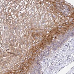 Airway Trypsin-like Protease/HAT/TMPRSS11D Antibody, Novus Biologicals:Antibodies:Primary