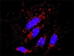 AKT3 Antibody (6E11), Novus Biologicals 0.1 mg | Buy Online | Novus Biologicals | Fisher Scientific