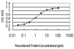 AKT3 Antibody (6E11), Novus Biologicals 0.1 mg | Buy Online | Novus Biologicals | Fisher Scientific