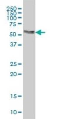 AKT3 Antibody (6E11), Novus Biologicals 0.1 mg | Buy Online | Novus Biologicals | Fisher Scientific