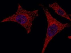 Alanyl tRNA synthetase Antibody, Novus Biologicals 100 &mu;g; Unconjugated:Antibodies,