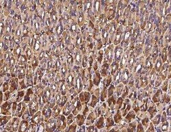 Alanyl tRNA synthetase Antibody, Novus Biologicals 100 &mu;g; Unconjugated:Antibodies,