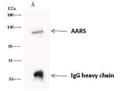 Alanyl tRNA synthetase Antibody, Novus Biologicals 50 &mu;g, Unconjugated:Antibodies,
