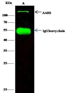 Alanyl tRNA synthetase Antibody, Novus Biologicals 100 &mu;g; Unconjugated:Antibodies,