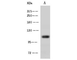 Alanyl tRNA synthetase Antibody, Novus Biologicals 50 &mu;g, Unconjugated:Antibodies,