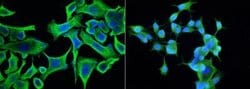 Aldehyde Dehydrogenase 1-A1/ALDH1A1 Rabbit anti-Human, Clone: 23, Novus