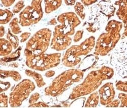 Aldehyde Dehydrogenase 1-A1/ALDH1A1 Rabbit anti-Human, Clone: ALDH1A1/7011R,