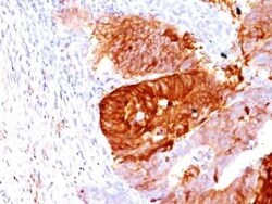 Aldehyde Dehydrogenase 1-A1/ALDH1A1 Antibody (ALDH1A1/1381), Novus Biologicals:Antibodies:Primary
