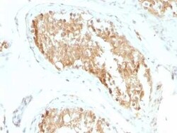 Aldehyde Dehydrogenase 1-A1/ALDH1A1 Antibody (ALDH1A1/1381), Novus Biologicals:Antibodies:Primary