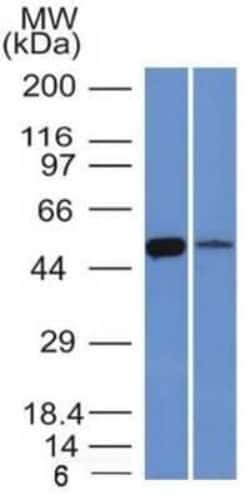 Aldehyde Dehydrogenase 1-A1/ALDH1A1 Antibody (ALDH1A1/1381), Novus Biologicals:Antibodies:Primary