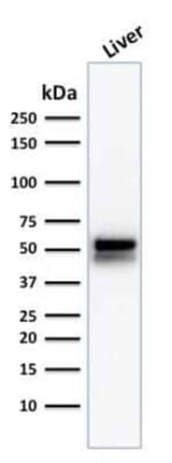 Aldehyde Dehydrogenase 1-A1/ALDH1A1 Antibody (ALDH1A1/1381), Novus Biologicals:Antibodies:Primary