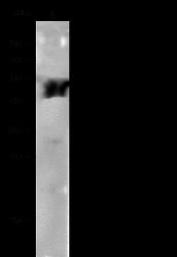 Aldehyde Dehydrogenase 3-A1/ALDH3A1 Rabbit anti-Human, Clone: 316, Novus
