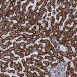 Aldehyde dehydrogenase 5 Rabbit anti-Human, Polyclonal, Novus Biologicals:Antibodies:Primary