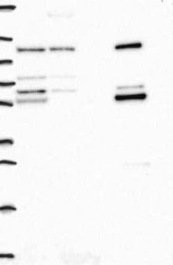 Aldehyde dehydrogenase 5 Rabbit anti-Human, Polyclonal, Novus Biologicals:Antibodies:Primary