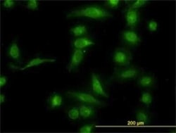 Aldo-keto Reductase 1B10/AKR1B10 Antibody (1A6), Novus Biologicals 0.1