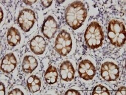 Aldo-keto Reductase 1B10/AKR1B10 Antibody (1A6), Novus Biologicals 0.1