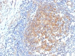 Aldo-keto Reductase 1C1/AKR1C1 Antibody (CPTC-AKR1C1-2) - Azide and BSA