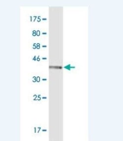 Aldo-keto Reductase 1C1/AKR1C1 Antibody (1B3), Novus Biologicals 100 &mu;g | Buy Online | Novus Biologicals | Fisher Scientific