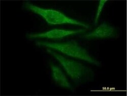 Aldo-keto Reductase 1C4/AKR1C4 Antibody (2C11), Novus Biologicals 0.1 mg | Buy Online | Novus Biologicals | Fisher Scientific
