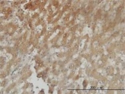 Aldo-keto Reductase 1C4/AKR1C4 Antibody (2C11), Novus Biologicals 0.1 mg | Buy Online | Novus Biologicals | Fisher Scientific