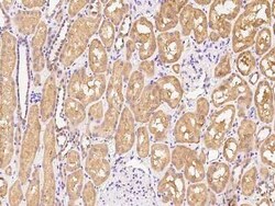 Aldo-keto Reductase 1C4/AKR1C4 Antibody, Novus Biologicals 50 &mu;g, Unconjugated:Antibodies,