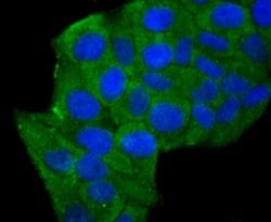 Aldolase A Rabbit anti-Human, Mouse, Rat, Zebrafish, Clone: JM54-19, Novus