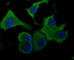 Aldolase A Rabbit anti-Human, Mouse, Rat, Zebrafish, Clone: JM54-19, Novus