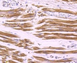 Aldolase A Rabbit anti-Human, Mouse, Rat, Zebrafish, Clone: JM54-19, Novus