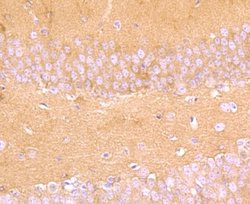 Aldolase A Rabbit anti-Human, Mouse, Rat, Zebrafish, Clone: JM54-19, Novus