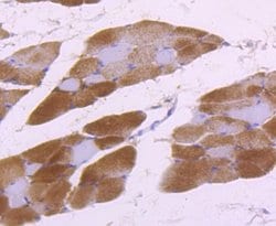 Aldolase A Rabbit anti-Human, Mouse, Rat, Zebrafish, Clone: JM54-19, Novus