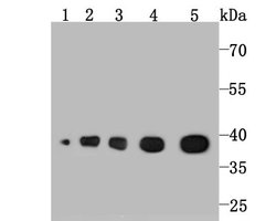 Aldolase A Rabbit anti-Human, Mouse, Rat, Zebrafish, Clone: JM54-19, Novus