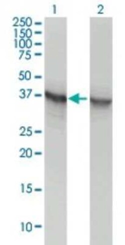 Aldolase A Antibody (3C12-6D11), Novus Biologicals 0.1 mg | Buy Online | Novus Biologicals | Fisher Scientific
