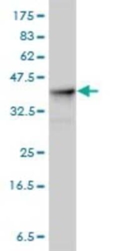Aldolase A Antibody (3D9-6F3), Novus Biologicals 0.1 mg | Buy Online | Novus Biologicals | Fisher Scientific