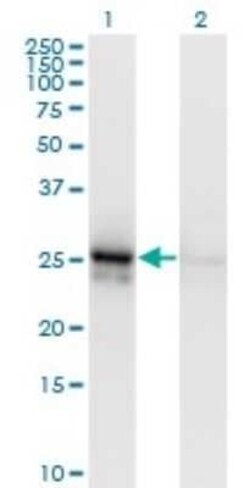 Aldolase A Antibody (3D9-6F3), Novus Biologicals 0.1 mg | Buy Online | Novus Biologicals | Fisher Scientific