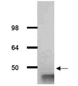 Aldolase A Antibody, Novus Biologicals 100 &mu;g; Unconjugated:Antikörper
