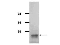 Aldolase A Antibody, Novus Biologicals 100 &mu;g; Unconjugated:Antikörper
