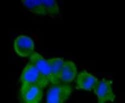 Alkaline Phosphatase, Tissue Non-Specific Antibody (SA40-00), Novus Biologicals
