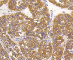 Alkaline Phosphatase, Tissue Non-Specific Antibody (SA40-00), Novus Biologicals