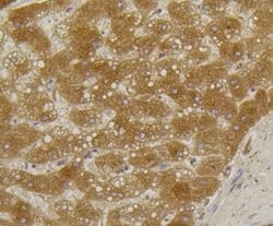 Alkaline Phosphatase, Tissue Non-Specific Antibody (SA40-00), Novus Biologicals