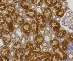 Alkaline Phosphatase, Tissue Non-Specific Antibody (SA40-00), Novus Biologicals