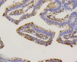 Alkaline Phosphatase, Tissue Non-Specific Antibody (SA40-00), Novus Biologicals