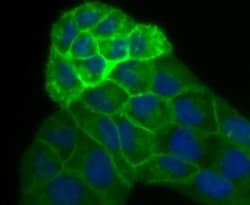 Alkaline Phosphatase/ALPP Antibody (JM22-53), Novus Biologicals 100&mu;L:Antibodies,