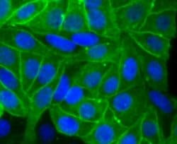 Alkaline Phosphatase/ALPP Antibody (JM22-53), Novus Biologicals 100&mu;L:Antibodies,