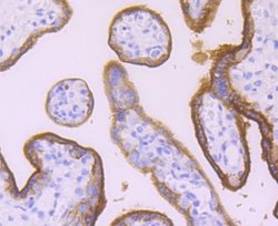 Alkaline Phosphatase/ALPP Antibody (JM22-53), Novus Biologicals 100&mu;L:Antibodies,