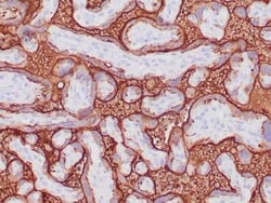 Alkaline Phosphatase/ALPP Antibody (ALP/870), Novus Biologicals:Antibodies:Primary