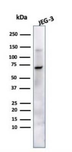 Alkaline Phosphatase/ALPP Antibody (ALP/870), Novus Biologicals:Antibodies:Primary